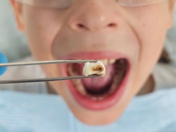 , TX Emergency Dental Service Company