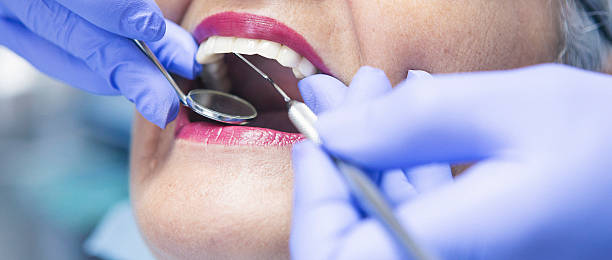 Best Emergency Wisdom Tooth Extraction in Dallas, TX